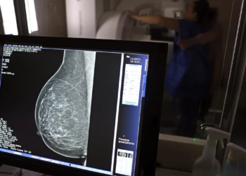 Mamografia © José Cruz I Via Agência Brasil