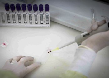 Secretaria de Saúde de SP monitora brasileira com suspeita de ebola após viagem ao Congo