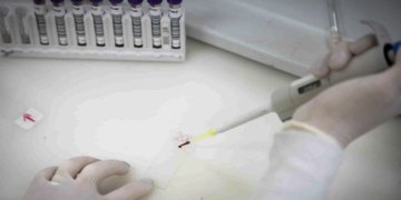 Secretaria de Saúde de SP monitora brasileira com suspeita de ebola após viagem ao Congo