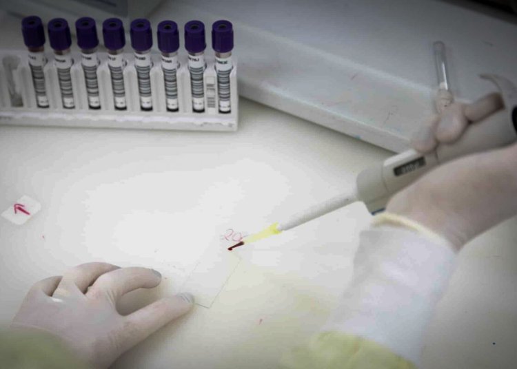 Secretaria de Saúde de SP monitora brasileira com suspeita de ebola após viagem ao Congo