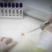 Secretaria de Saúde de SP monitora brasileira com suspeita de ebola após viagem ao Congo