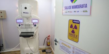 Cirurgias mamárias no SUS saltam mais de 50% em uma década e revelam disparidade regional