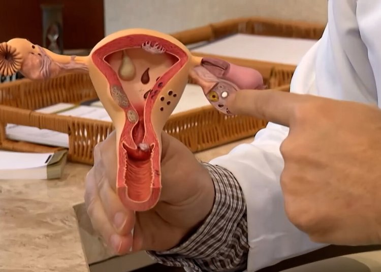 CNPq destina R$ 60 milhões para projetos de combate à endometriose e saúde menstrual no SUS