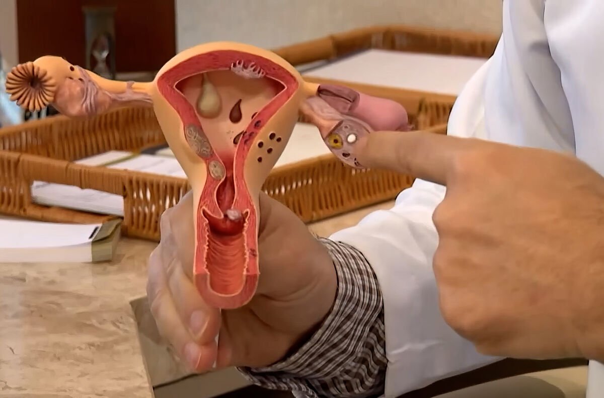 CNPq destina R$ 60 milhões para projetos de combate à endometriose e saúde menstrual no SUS
