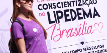 Lipedema afeta uma em cada dez brasileiras e mobilização nacional cobra diagnóstico correto