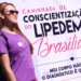 Lipedema afeta uma em cada dez brasileiras e mobilização nacional cobra diagnóstico correto