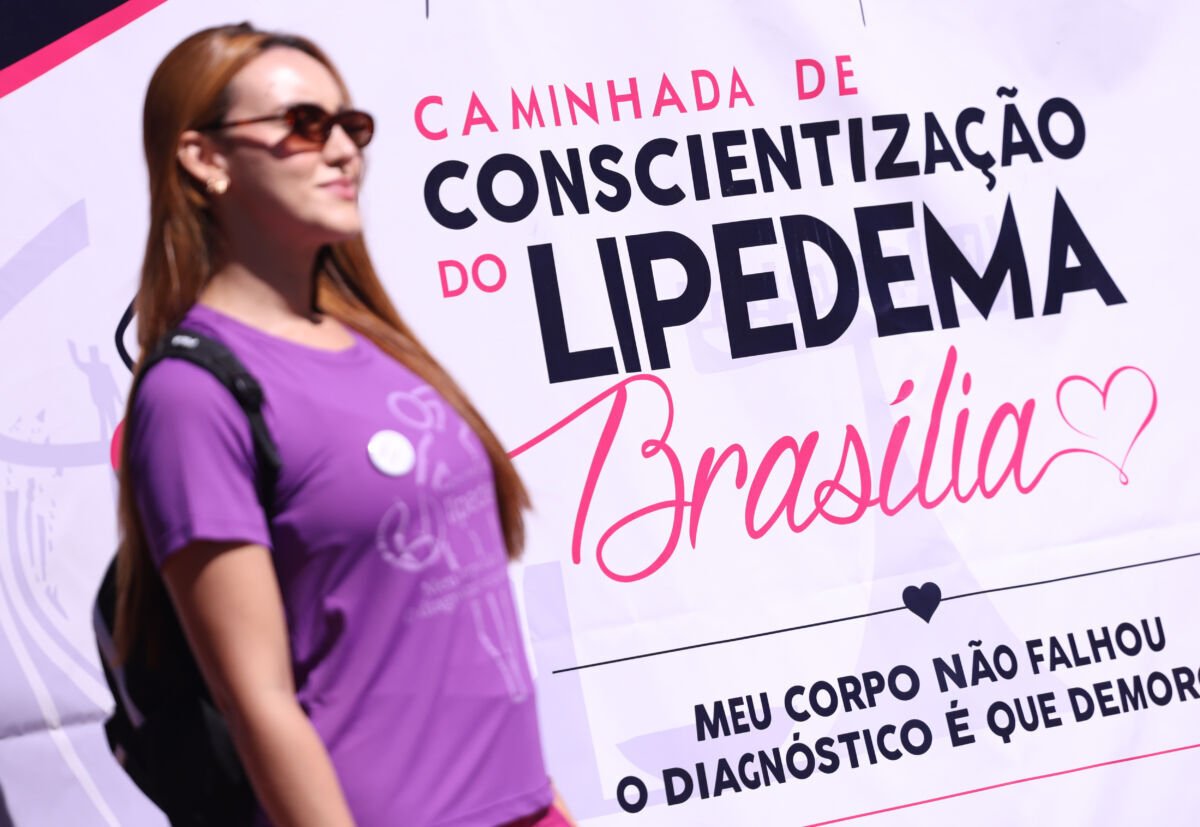Lipedema afeta uma em cada dez brasileiras e mobilização nacional cobra diagnóstico correto