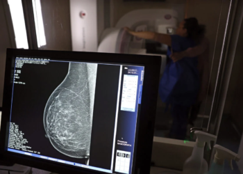 Mamografia digital ganha cobertura obrigatória em planos de saúde e amplia acesso a exames