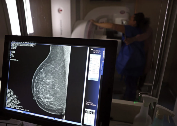 Mamografia digital ganha cobertura obrigatória em planos de saúde e amplia acesso a exames